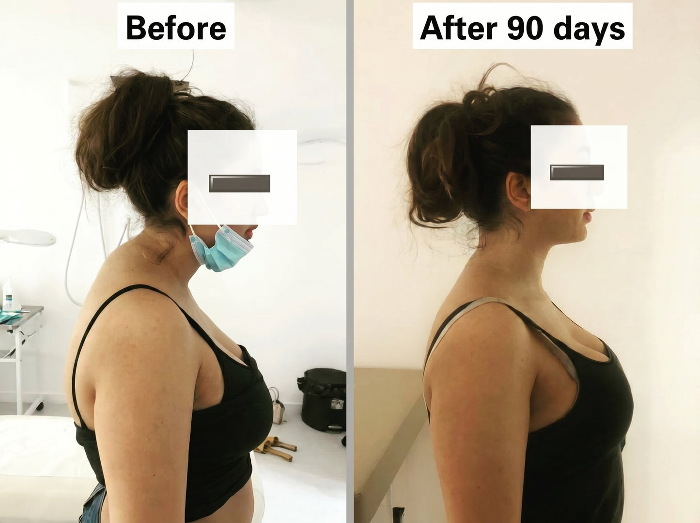 Nuvellery™ Pillow: Smooth Your Neck Hump in 30 Minutes a Day
